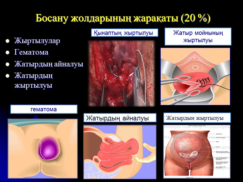 Босану жолдарының жарақаты (20 %) Жыртылулар Гематома Жатырдың айналуы  Жатырдың жыртылуы Қынаптың жыртылуы